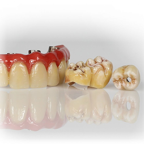 Professional Kit-Top Airstain Glaze | DST Dental